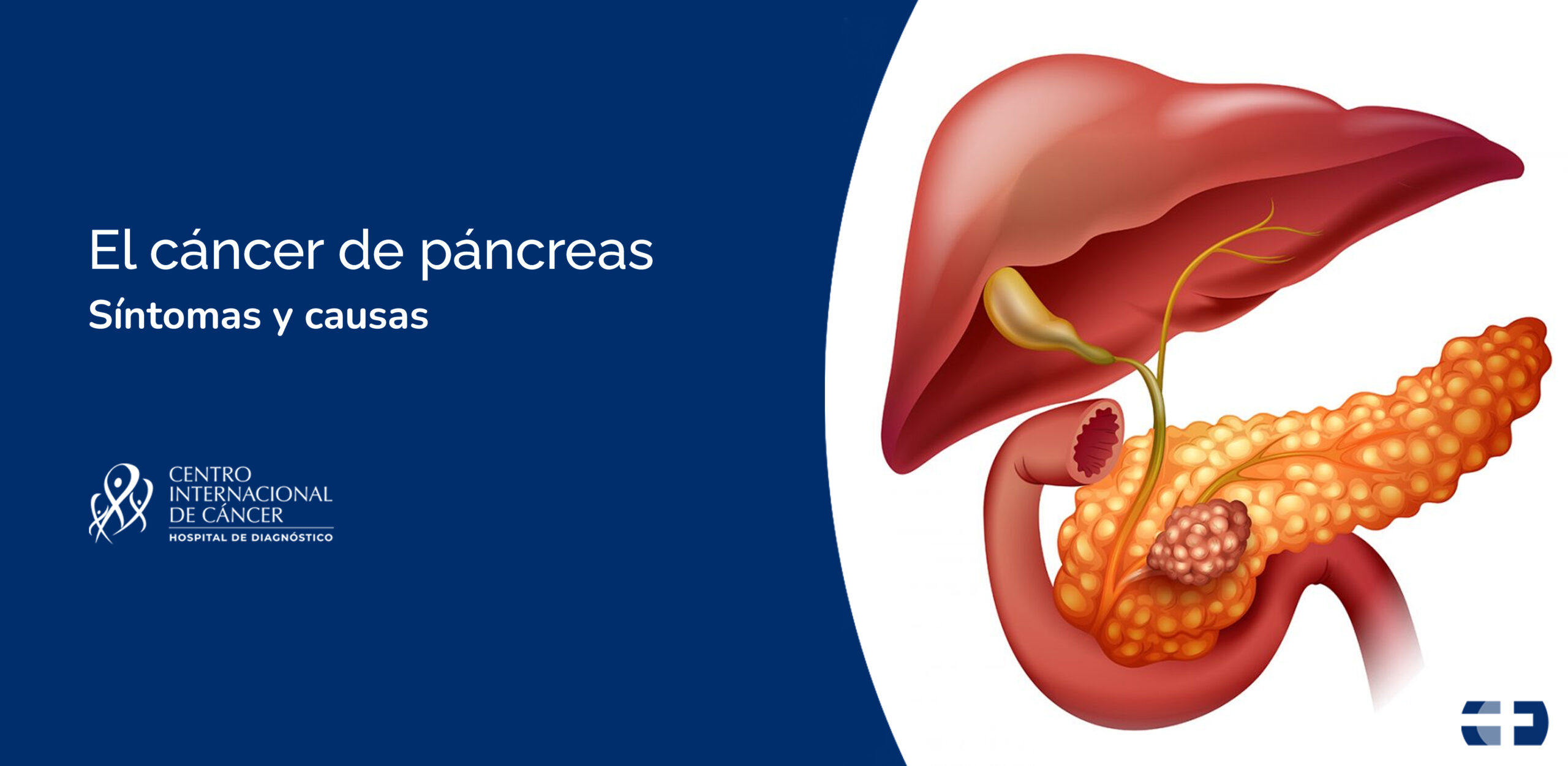 El C Ncer De P Ncreas S Ntomas Y Causas
