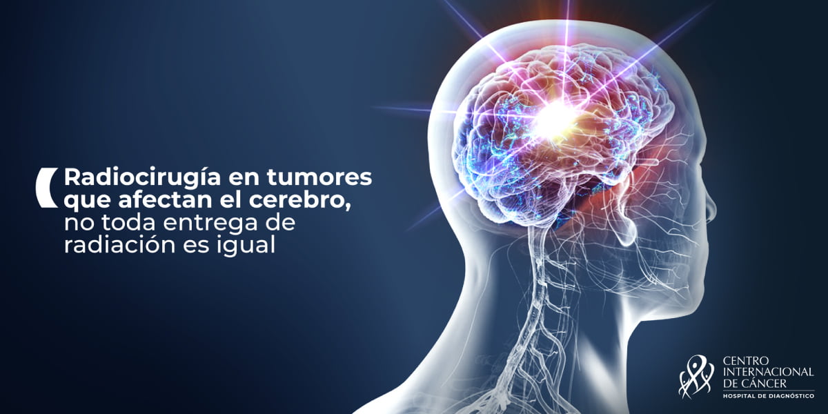 Radiocirugía en tumores que afectan al cerebro