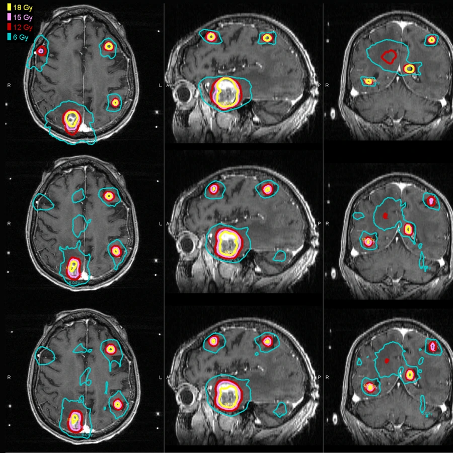 Evaluación médica para tratamiento con Gamma Knife Icon