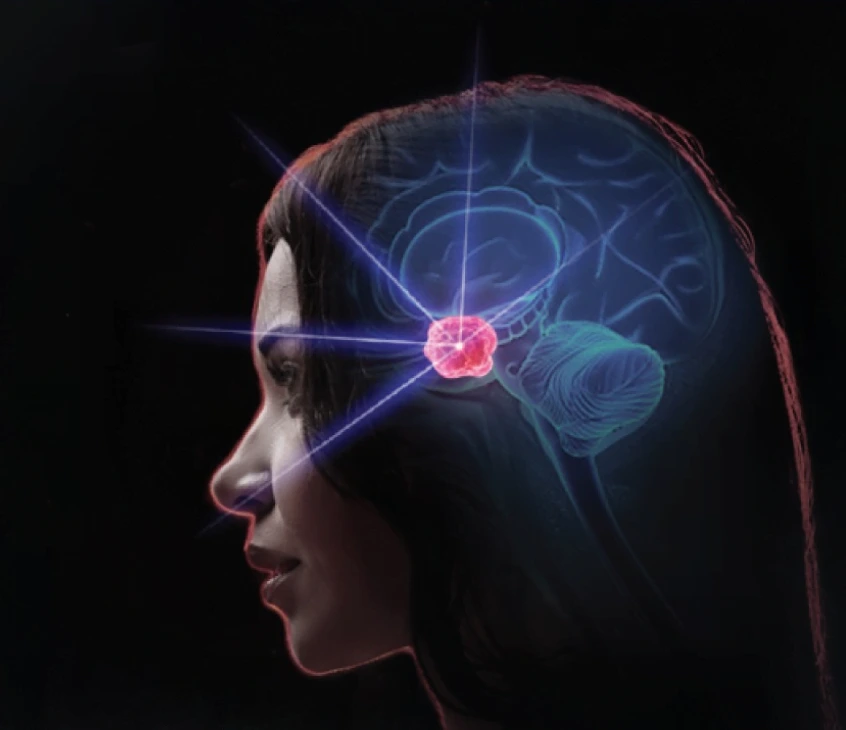 Tratamiento de tumores y metástasis cerebrales con Gamma Knife