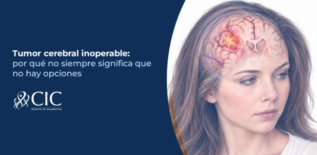 Tumor cerebral inoperable por qué no siempre significa que no hay opciones